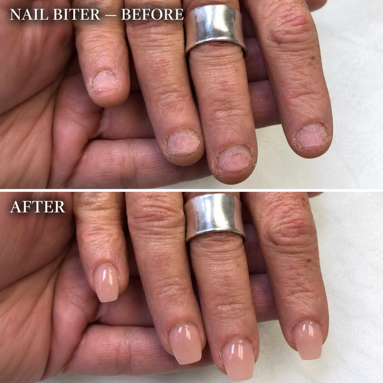 Nail biter before and after transformation with natural nude nail extensions