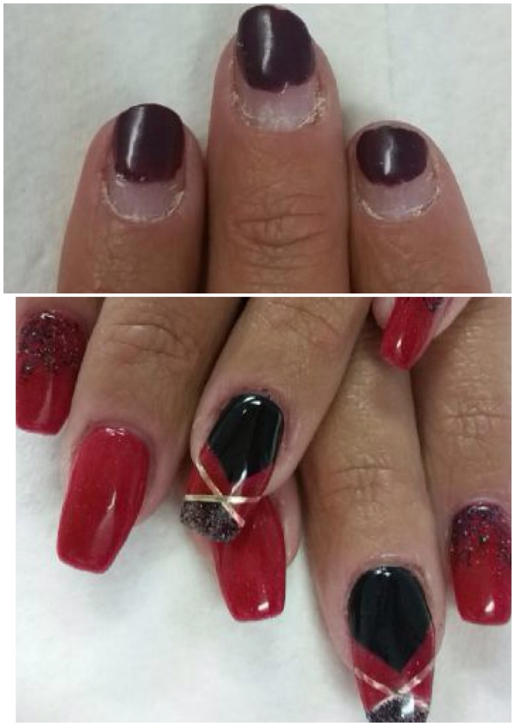Before and after nail enhancement transformation