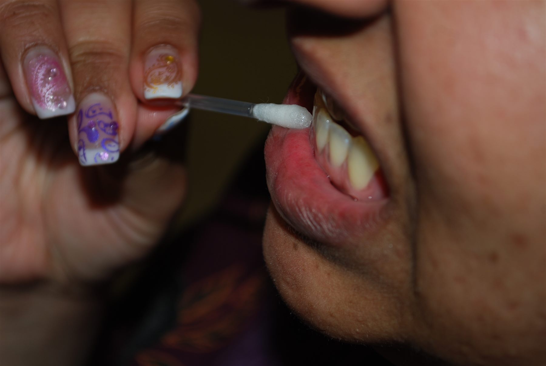 Gellen Pearl whitening gel swab application